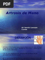 Artrosis de Mano