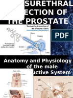 Transurethral Resection of The Prostate