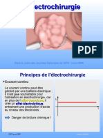 BISTOURI GIFE 09 Principes Electrocoagulation ERBE PDF