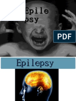 Epilepsy