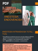 Anestesia Endovenosa