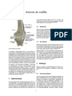 Artrosis de Rodilla