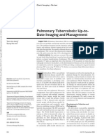 Pulmonary Tuberculosis: Up-to-Date Imaging and Management: Yeon Joo Jeong Kyung Soo Lee