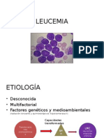 LEUCEMIA