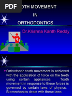 Tooth Movement in Orthodontics