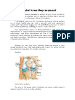 Total Knee Replacement