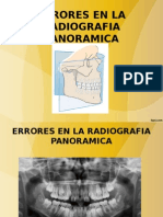 Clase N 2 Errores en La Radiografia Panoramica 16 de Abril Del 2015