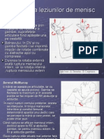 LP Recup Dupa Artroscopie de Menisc