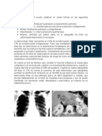 Tuberculosis Miliar