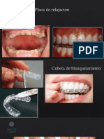 Maloclusion