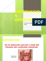 Obstruccion Intestinal