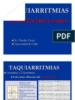 Taquiarritmias