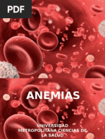 Anemias Grupo D