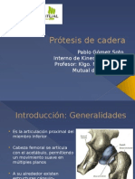 Protesis de Cadera y RHB