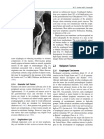 Esophageal Carcinoma Info