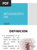 Intususcepción