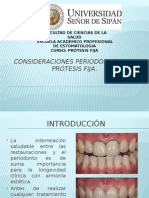 Consideraciones Periodontales en Prótesis Fija