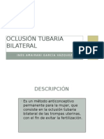 Oclusion Tubaria Bilateral.