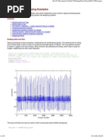 Matlab Signal Processing Examples