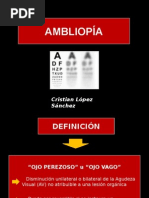 Ambliopia 