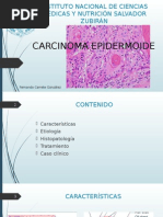 Carcinoma Epidermoide