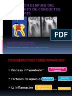 Reparación Después Del Tratamiento de Conductos Radiculares