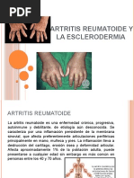 Artritis Reumatoide y La Esclerodermia