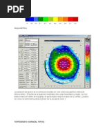 Paquimetria Topografia Corneal