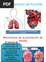 Edema Agudo Pulmonar