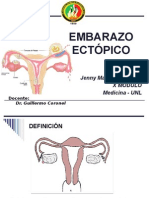 Embarazo Ectopico