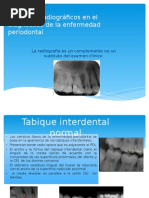 Auxiliares Radiográficos en El Diagnostico de La Enfermedadperiodontal