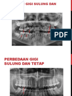 Perbedaan Radiografi Gigi Sulung & Tetap