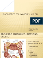 Diagnóstico Por Imágenes: Colon