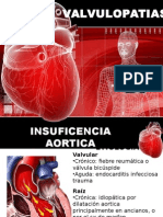 Valvulopatias Cardiacas