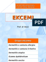 Ekcemi