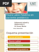 Clase Fisura Labio Palatina en Paciente Pediátrico