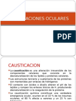 Causticaciones Oculares