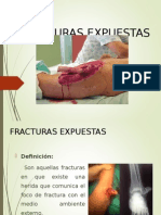 Fractura Expuesta