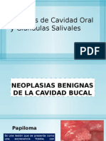 Tumores de Cavidad Oral y Glandulas Salivales