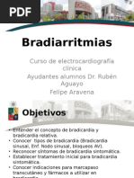 Bradiarritmias