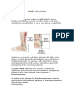 Bursitis Retrocalcanea