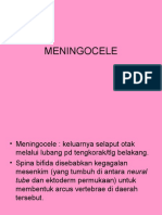 MENINGOCELE