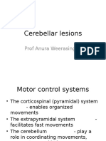 Cerebellar Lesions: Prof Anura Weerasinghe