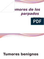 Tumores de Los Parpados