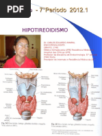 Hipotireoidismo Aula 