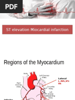 ST Elevation Miocardial Infarction