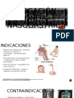 Colocación de Sonda Nasogástrica