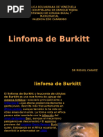 Linfoma de Burkitt