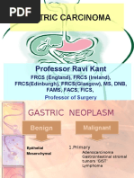 Gastric Carcinoma: Professor Ravi Kant