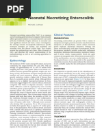 Neonatal Necrotizing Enterocolitis: Clinical Features